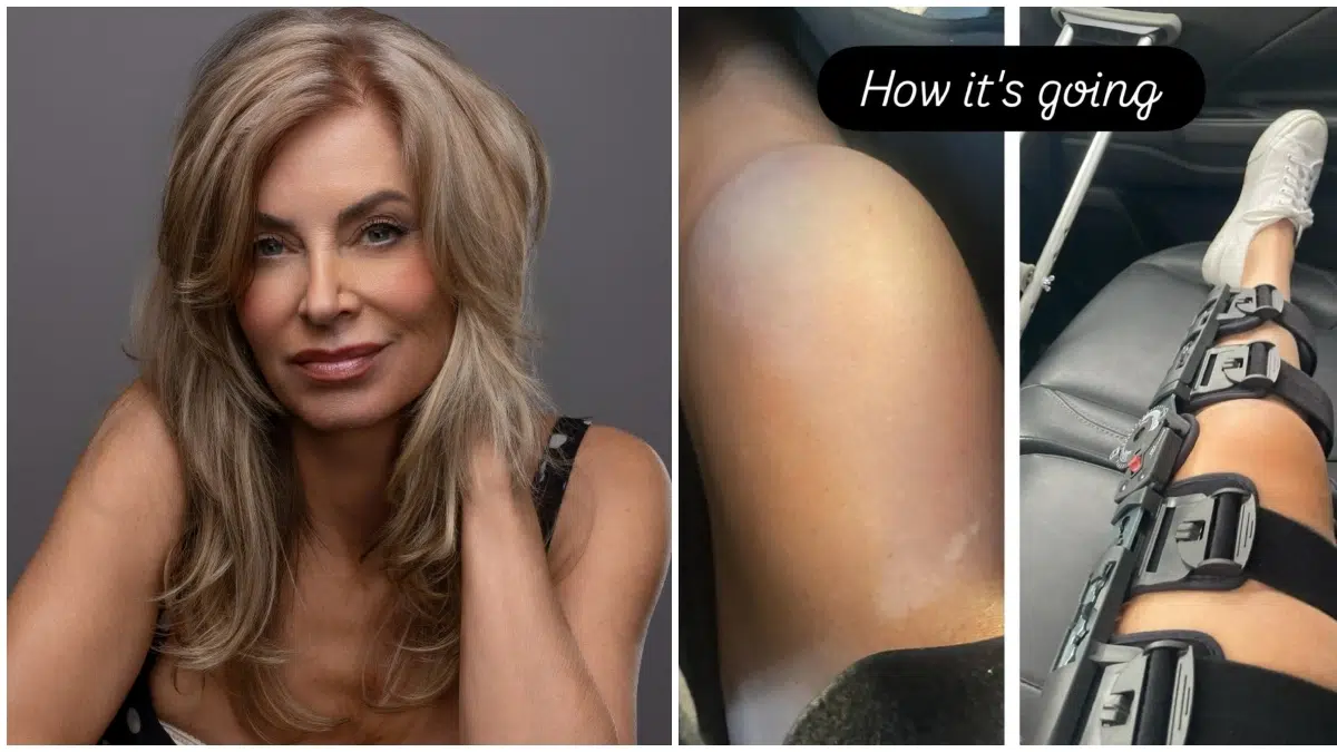 Y&R Star Eileen Davidson Faces Weeks of Recovery After Painful Accident